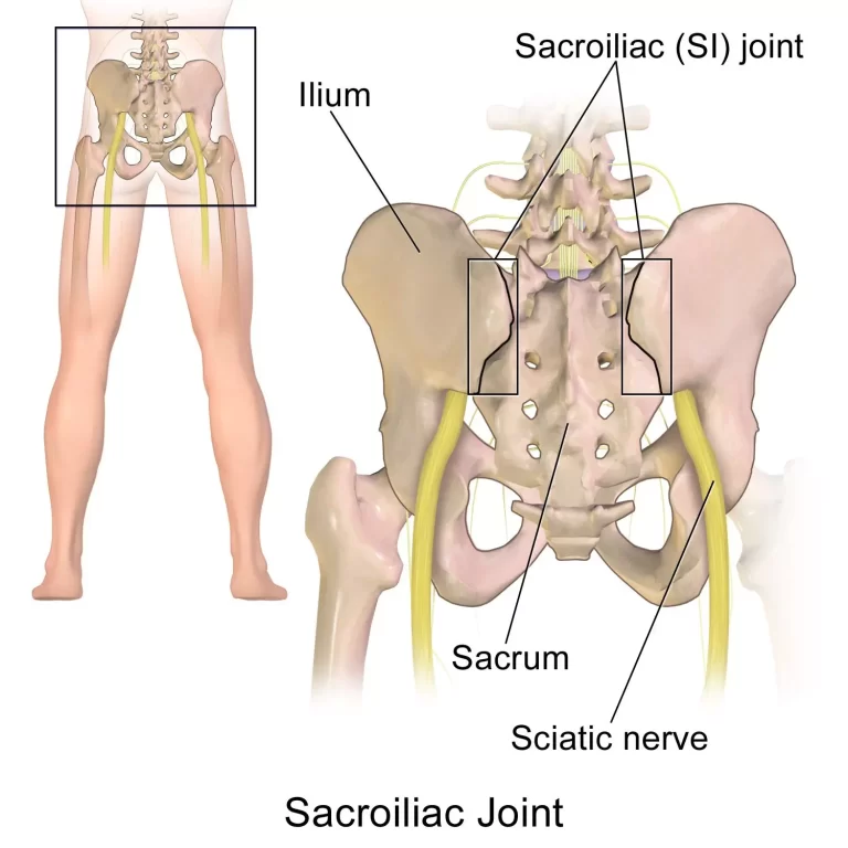 Pinched Nerve (Back) | Orchard Health Clinic