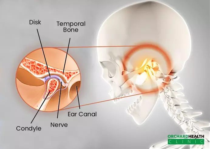 TMJ disorder Symptoms and causes TMJ treatment TMJ disorder Symptoms and causes TMJ treatment | Orchard Health Clinic