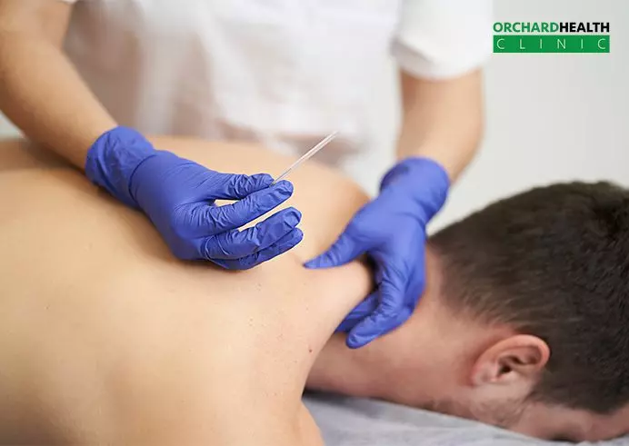 Dry Needling Therapy | Orchard Health Clinic
